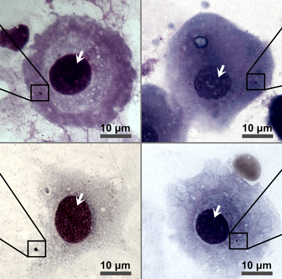 Pollution reaches the placenta in pregnant women, study finds